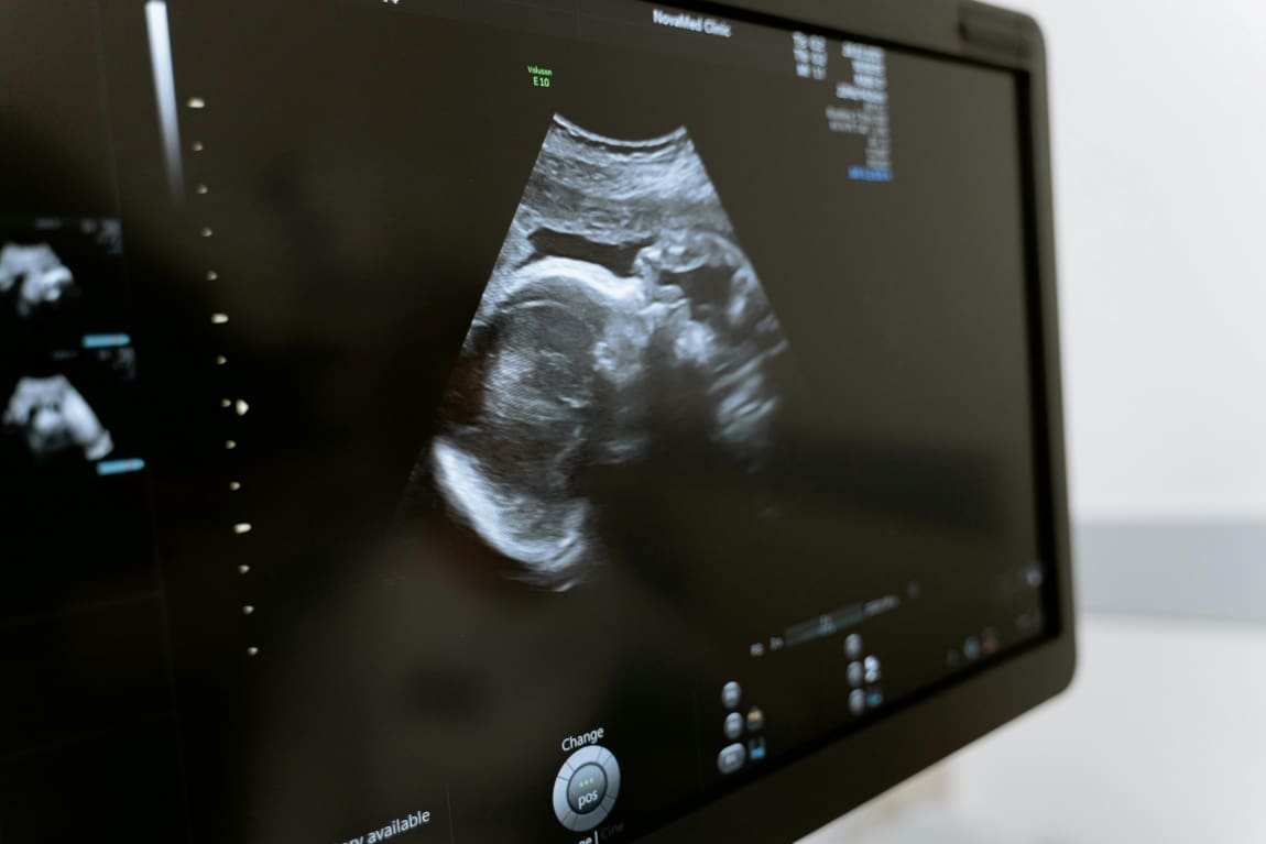 Image: computer, scan, health. hospital