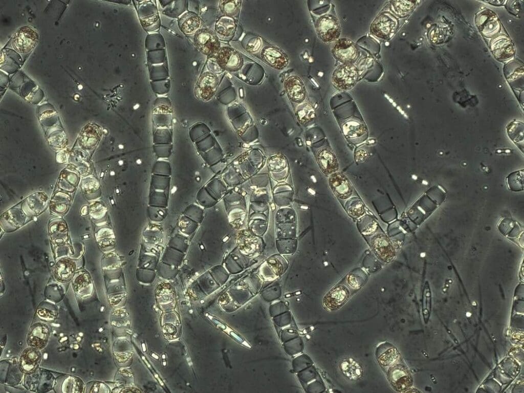 This microscope image shows various species of ice algae, magnified 400x