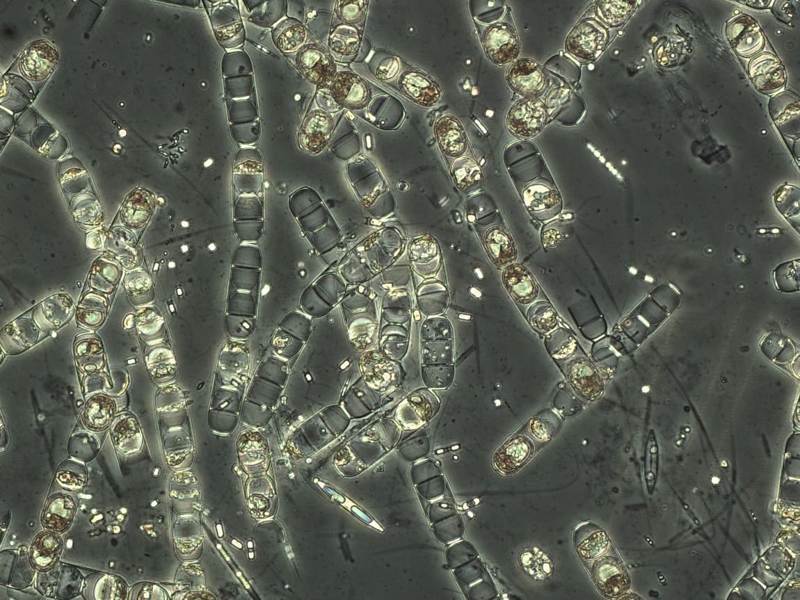This microscope image shows various species of ice algae, magnified 400x