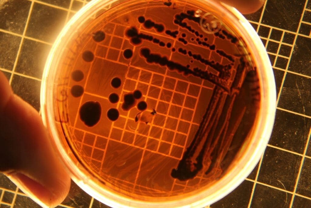 Image: Bacterial Colonies