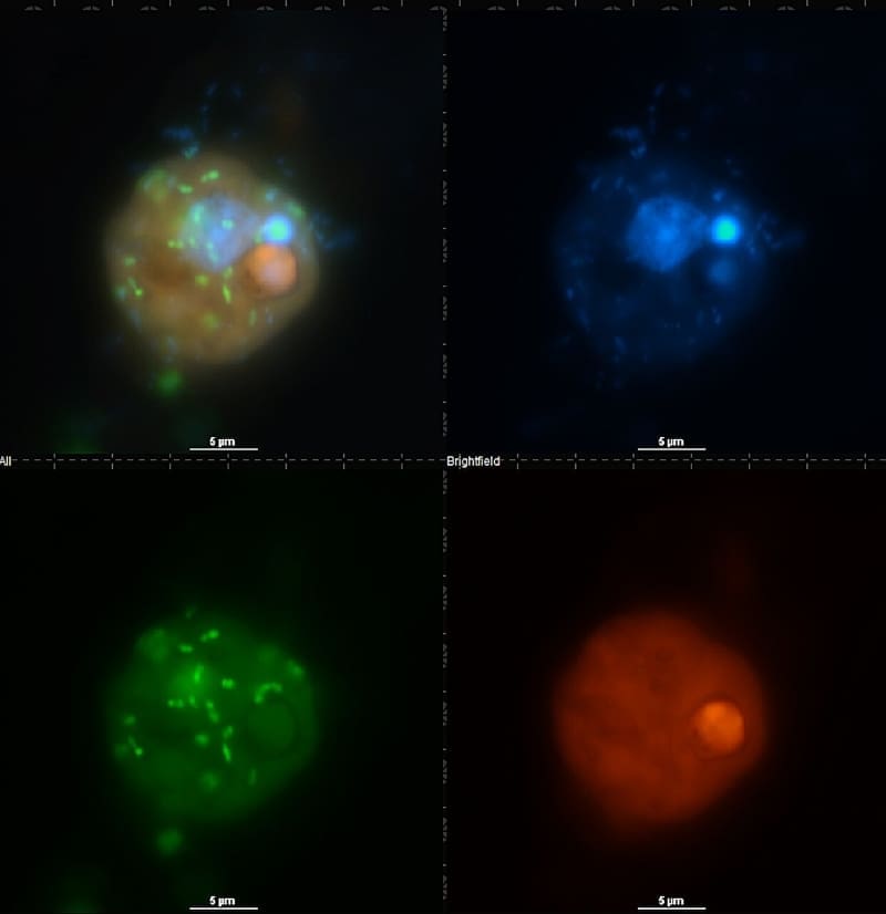 climate change plankton res