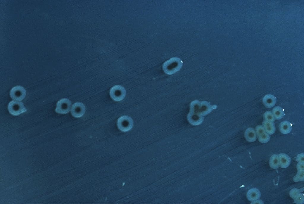 Climate change fuels rise in salmonella risk from raw produce muser Salmonella enterica