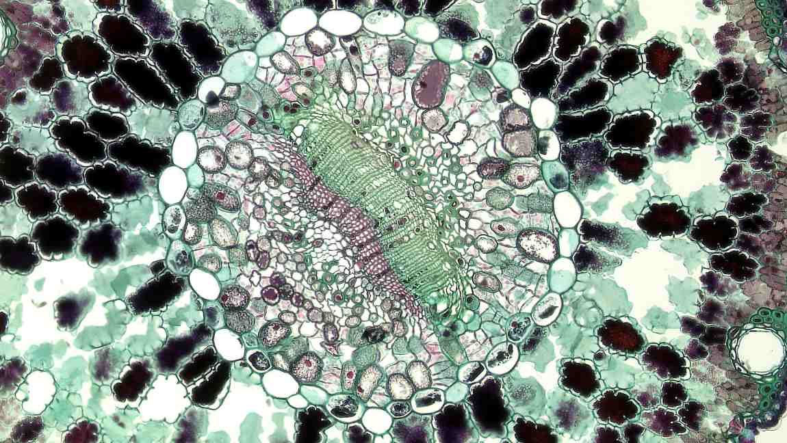 Image: Cell seen under microscope