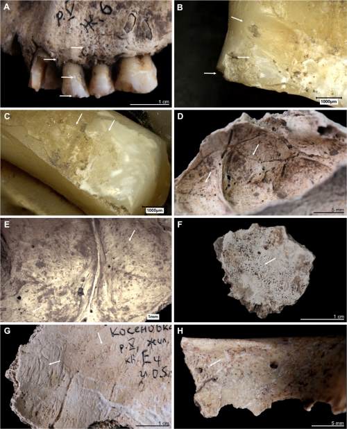 Stone Age discovery uncovers life and death of ancient Ukrainian communities fragments stone age ukraine res