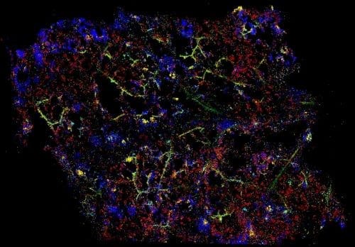 Climate Science Digest: January 8, 2025 Gene expression visualized in a section of a pathogen-infected plant leaf.