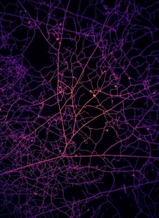 Image: Arbuscular mycorrhizal network