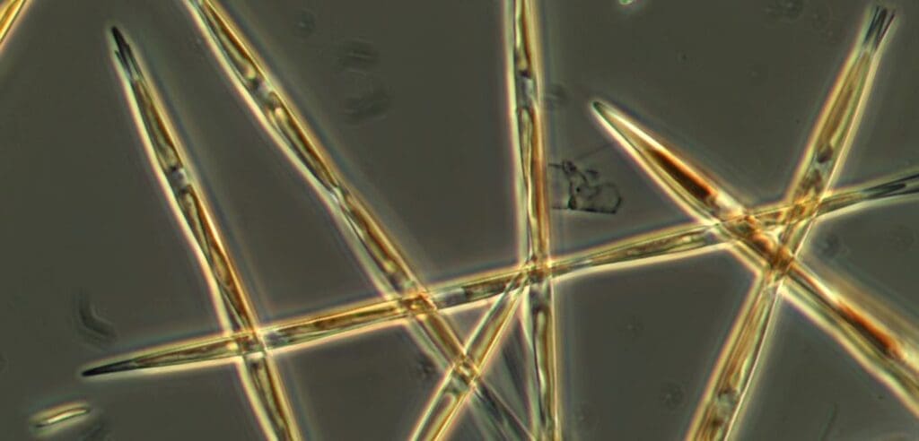 Mapping algae interactions to predict harmful algal blooms Image: Algae in the genus Pseudo-nitzschia produce domoic acid, a toxin that can cause amnesic shellfish poisoning