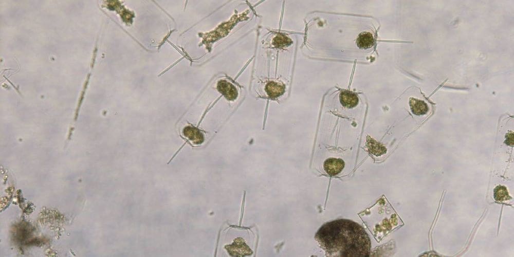 Image: North Sea Plankton (s. marine heatwaves, plankton, climate change)
