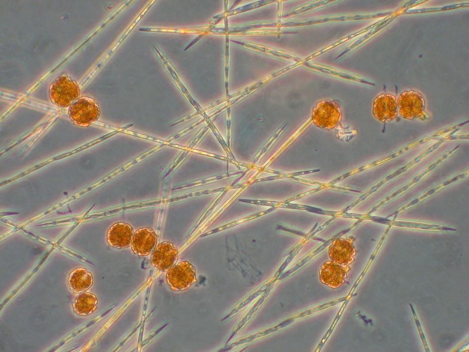 Bowhead whale samples reveal link between Arctic warming and rising algal toxins Image: Harmful algal blooms