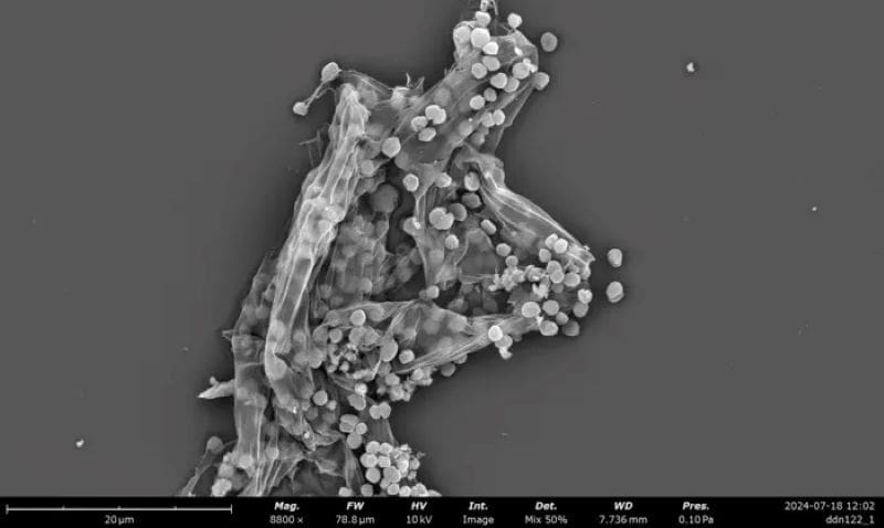 Climate Science Digest: August 17, 2025 Image: Methanogens
