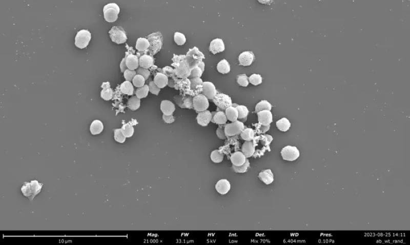 Image: Electron microscope image of methanogens 