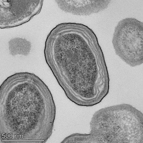 Image: Prochlorococcus cells 