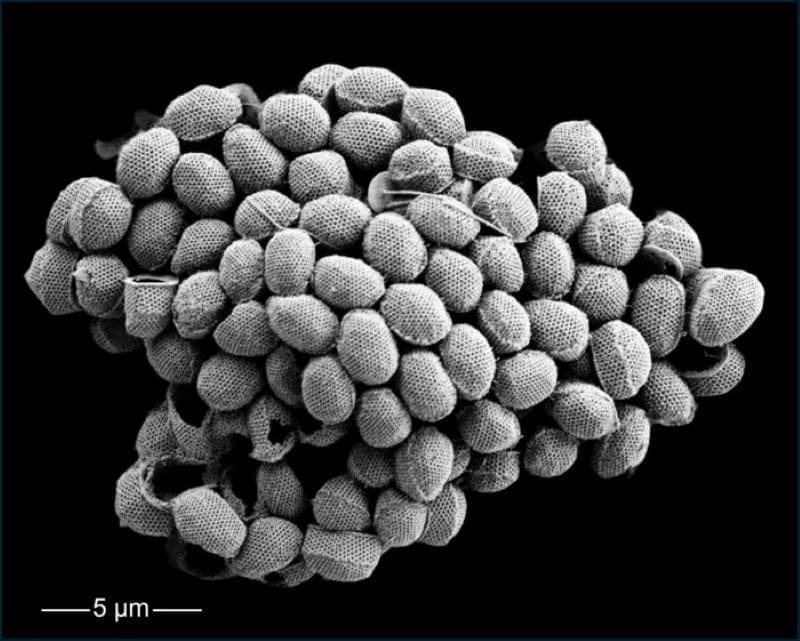 Image: A coccosphere of a holococcolithophore (s. plankton, climate change)