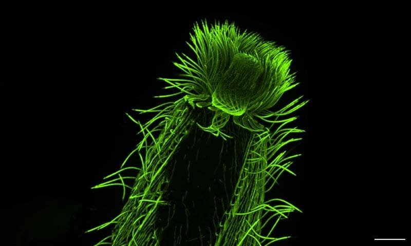Image: Expansion microscopy image of Lacrymaria