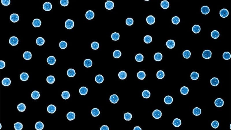 Image: Nanoparticles of platinum