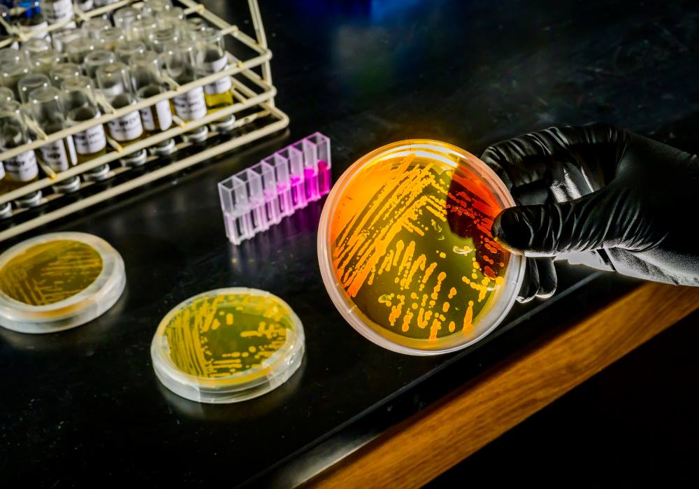 Image: Nitrosopumilus maritimus culture