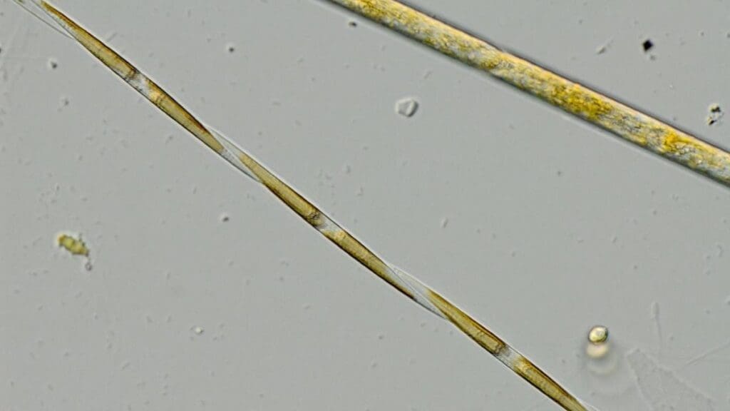 Image: Pseudo-nitzschia